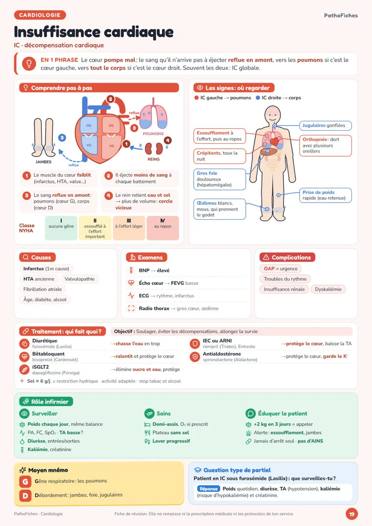 Fiche Insuffisance cardiaque de PathoFiches